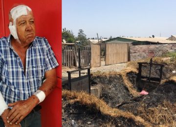 agricultor quemado quillota