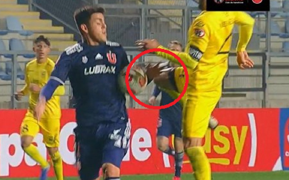 mano u de chile san luis