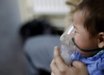 virus sincicial niños