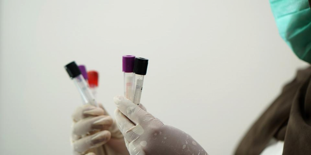 manos sosteniendo muestras de pcr de coronavirus covid19 examenes