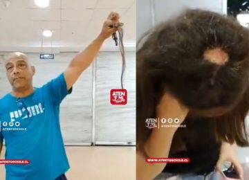 Denuncian que joven sufrió quemaduras por procedimientos en peluquería de Quilpué