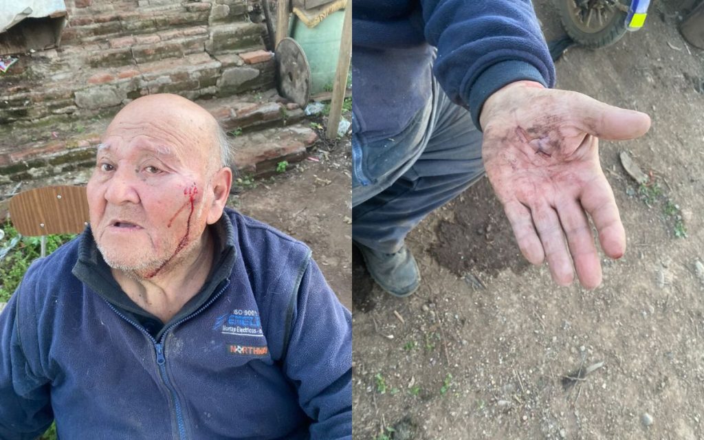 En Nogales hombre adicto a la pasta base golpeó y le robó a adulto mayor