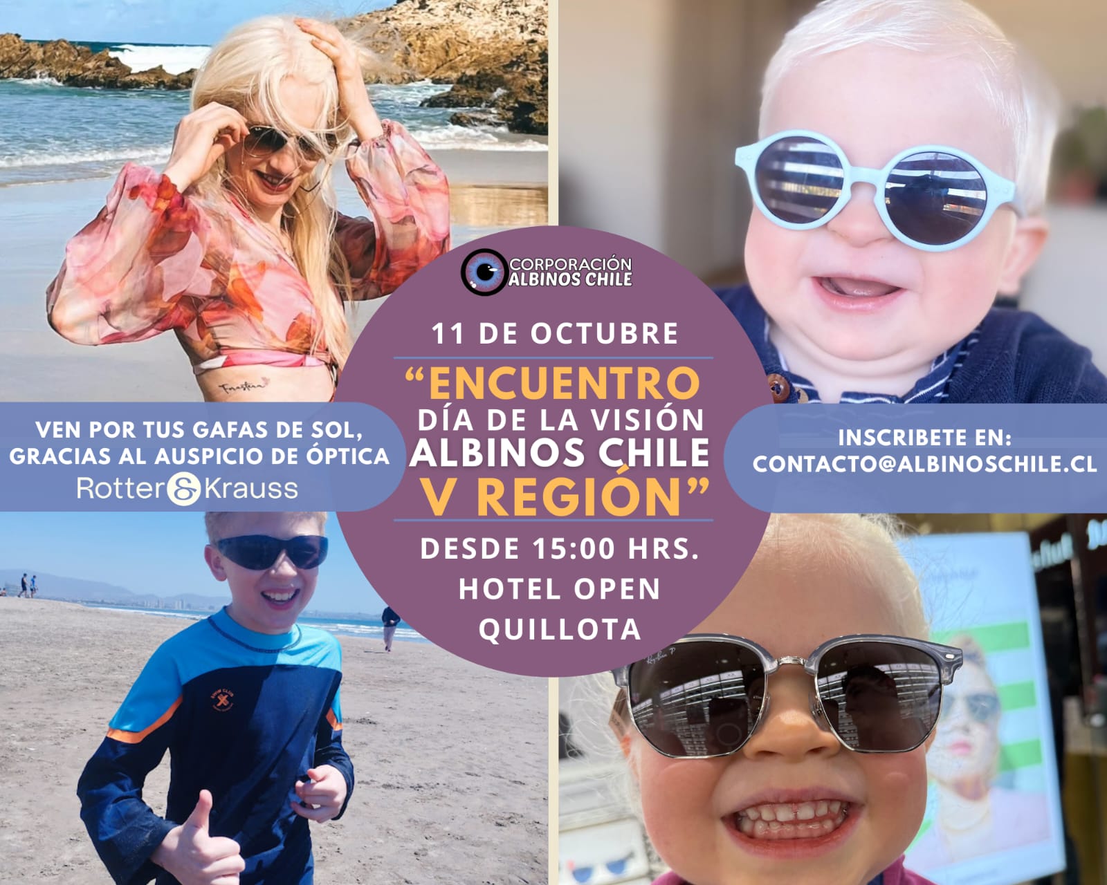 Albinos de la Región se reunirán en Quillota por el Mes de la Visión