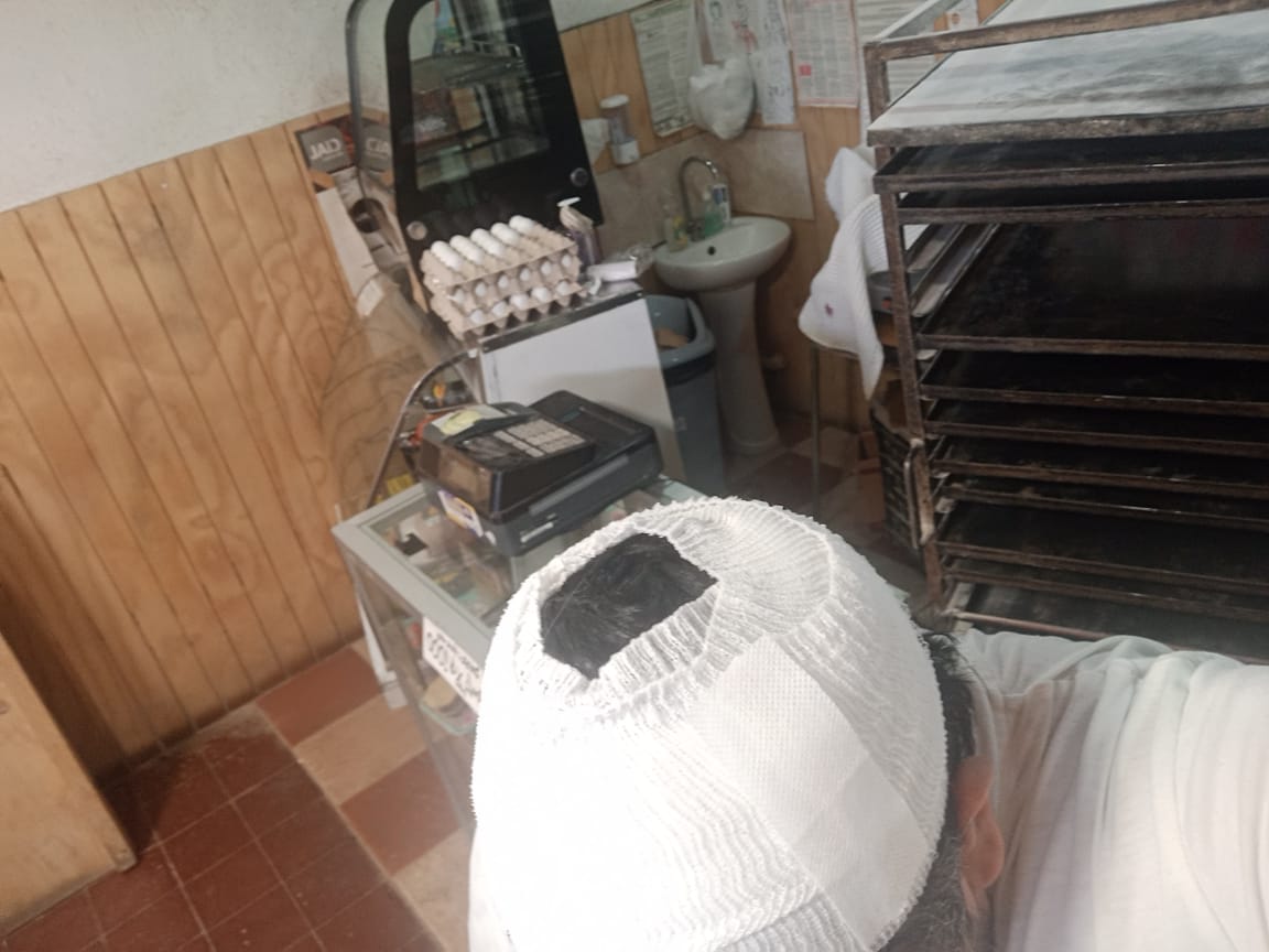 Comerciante herido relata intento de robo en San Pedro