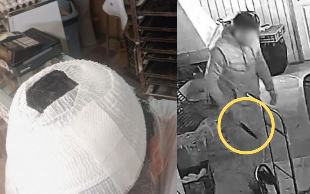 Comerciante herido relata intento de robo en San Pedro: "Tenían un cuchillo de 20 centímetros"