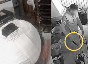 Comerciante herido relata intento de robo en San Pedro: "Tenían un cuchillo de 20 centímetros"
