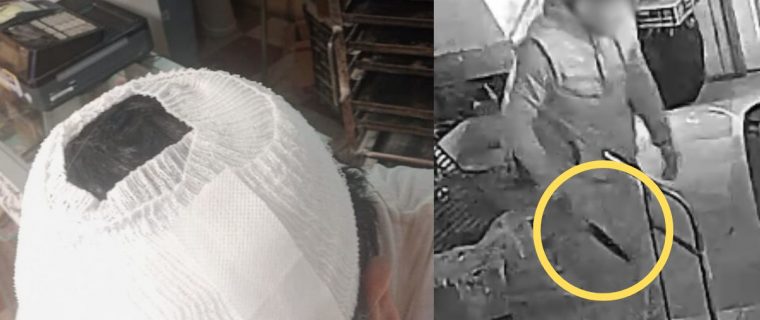 Comerciante herido relata intento de robo en San Pedro: "Tenían un cuchillo de 20 centímetros"