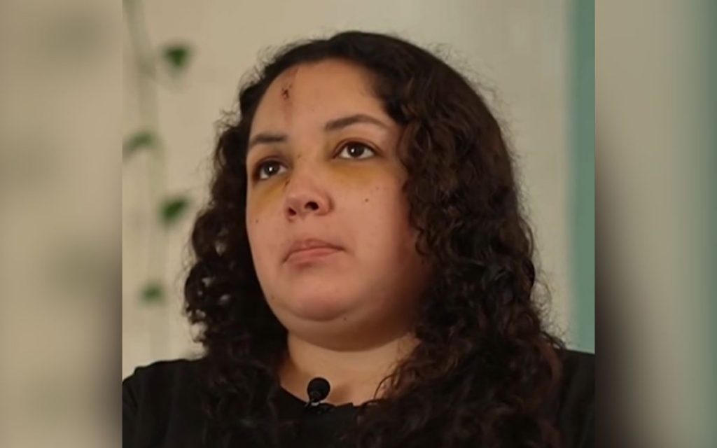 [VIDEO] Trabajadora habló sobre la agresión que sufrió en residencia de menores de Quillota