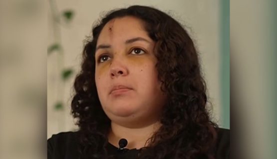 [VIDEO] Trabajadora habló sobre la agresión que sufrió en residencia de menores de Quillota