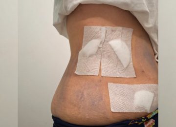 "Me decía que esto era un encargo”: Mujer denunció agresión con arma blanca en Quillota
