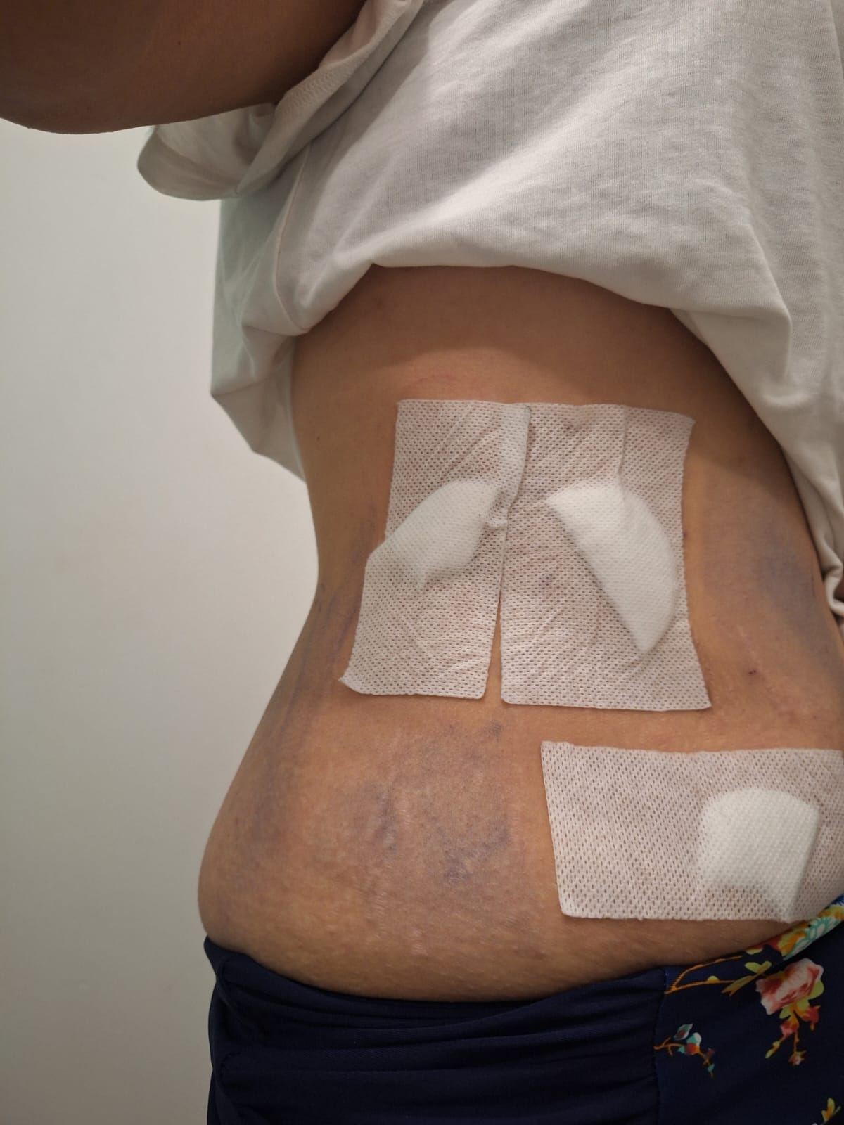 Mujer denunció agresión con arma blanca en Quillota
