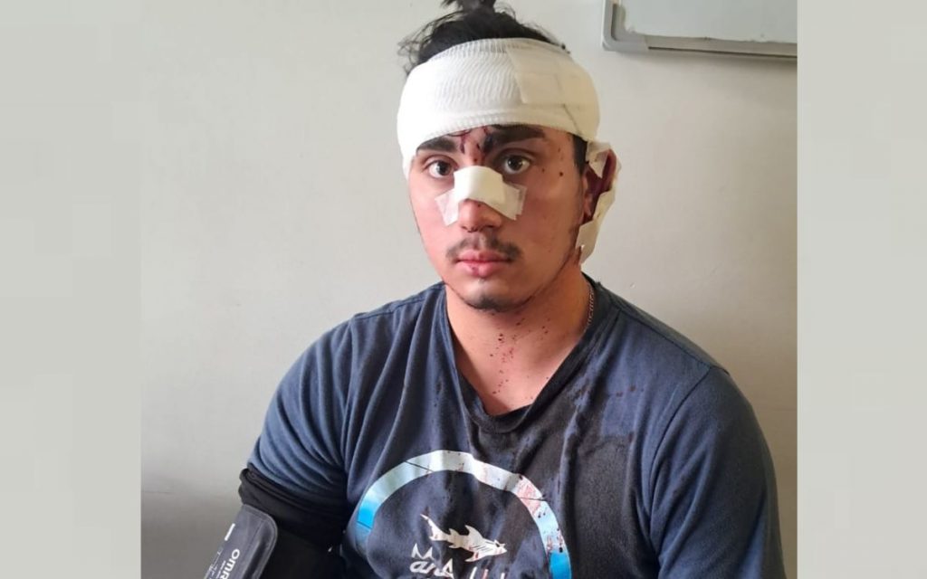 Joven de 20 años fue brutalmente agredido en el centro de La Calera