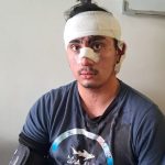 Joven de 20 años fue brutalmente agredido en el centro de La Calera