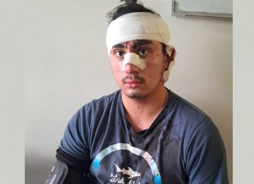 Joven de 20 años fue brutalmente agredido en el centro de La Calera