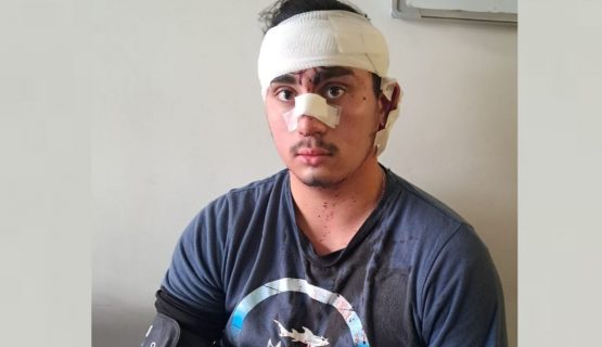 Joven de 20 años fue brutalmente agredido en el centro de La Calera