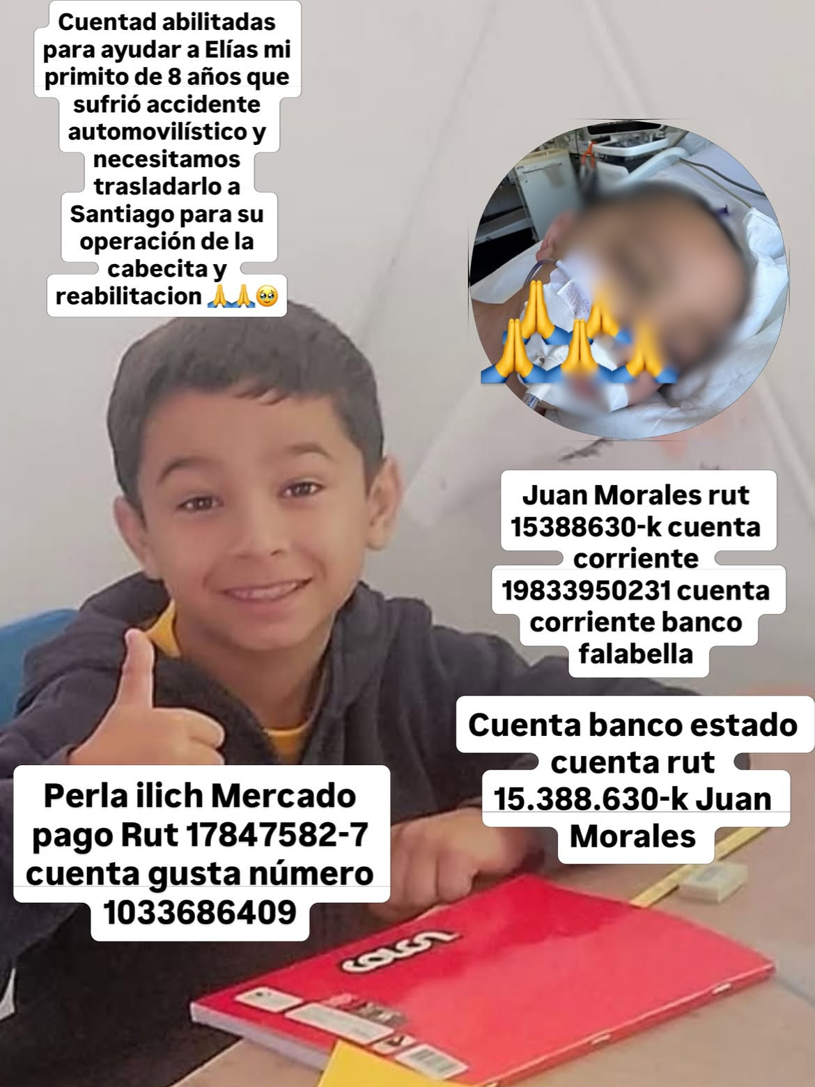 $159 millones se necesitan para operar a niñito grave tras accidente en Quillota
