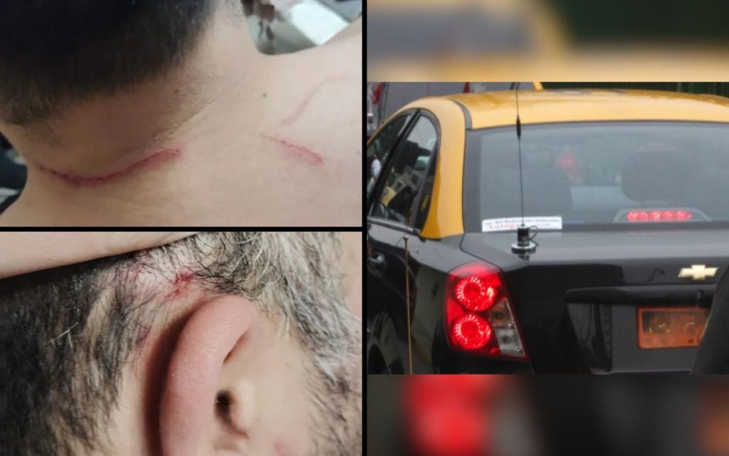 Quillota: Conductor de aplicación se defendió de asaltantes y frustró robo