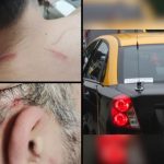 Quillota: Conductor de aplicación se defendió de asaltantes y frustró robo