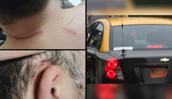 Quillota: Conductor de aplicación se defendió de asaltantes y frustró robo